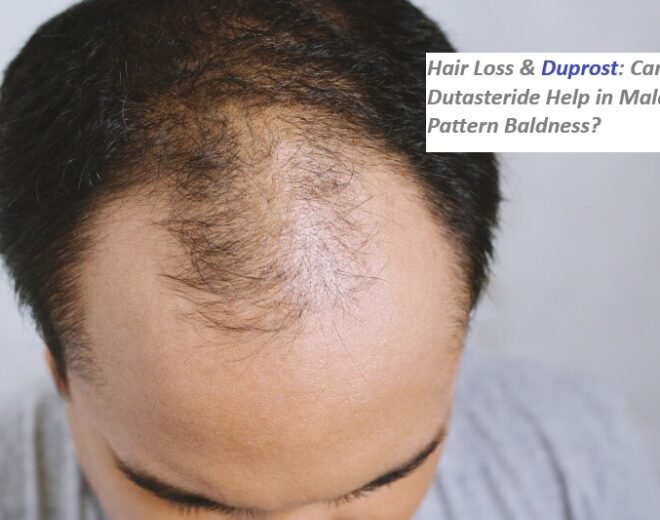 hairline-balding